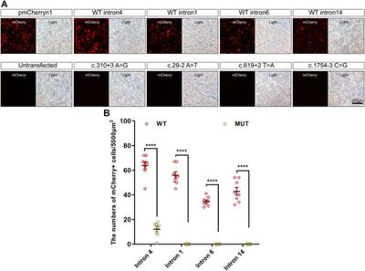 Analysis of RPGR gene mutations in 41 Chinese families affected by X-linked inherited retinal dystrophy